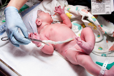 Umbilical Cord Blood Association Priorities Umbilical Cord Blood Association Priorities