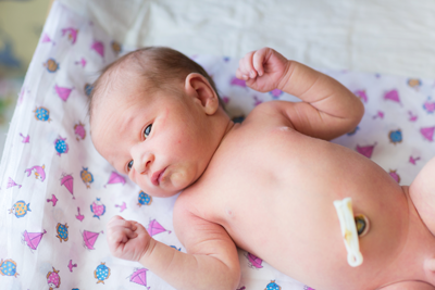 Umbilical Cord Blood Association Vision